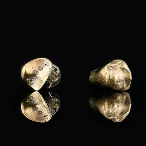 TANDGULD, total vikt 4,41 gram.